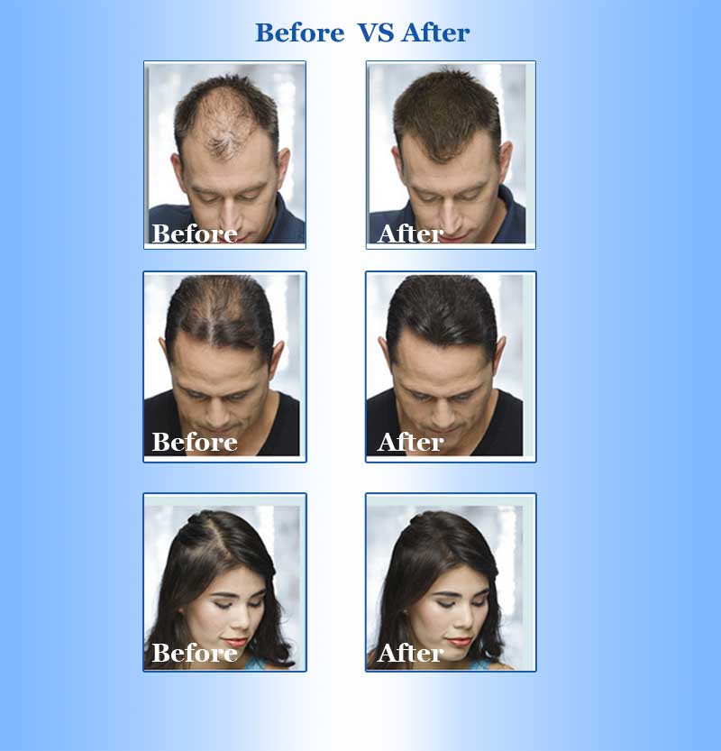 3 Types of Okeny's Women Men's Hair Growth Essence Oil Rapidly Increases Intensive Repair Type Anti- Loss Products