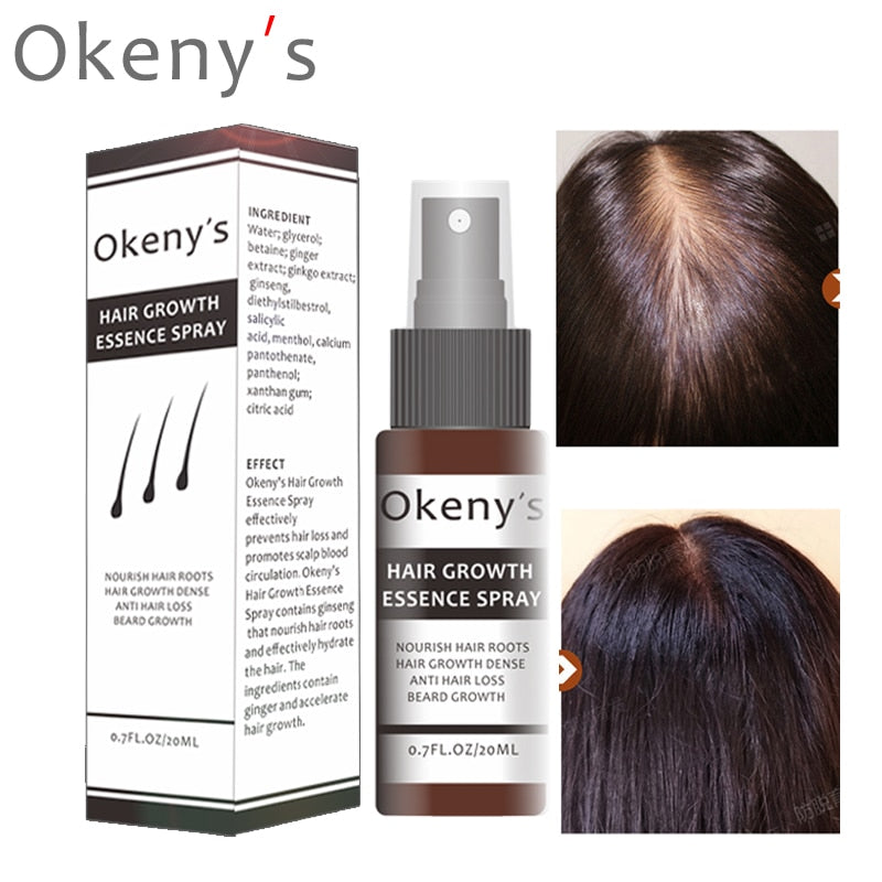3 Types of Okeny's Women Men's Hair Growth Essence Oil Rapidly Increases Intensive Repair Type Anti- Loss Products