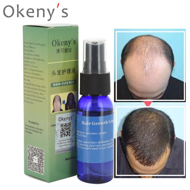 3 Types of Okeny's Women Men's Hair Growth Essence Oil Rapidly Increases Intensive Repair Type Anti- Loss Products